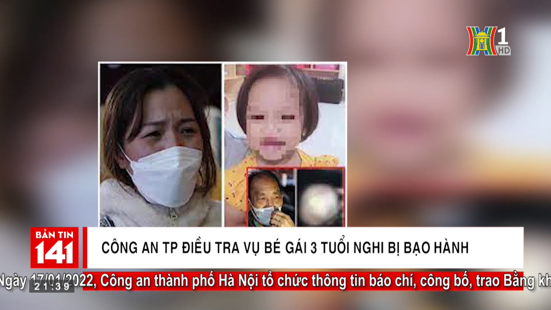 Công an TP Hà Nội điều tra vụ bé gái 3 tuổi bị bạo hành